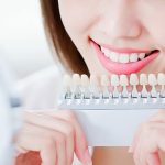 ホワイトニングは歯医者と美容サロンどちらで施術するのが良い？